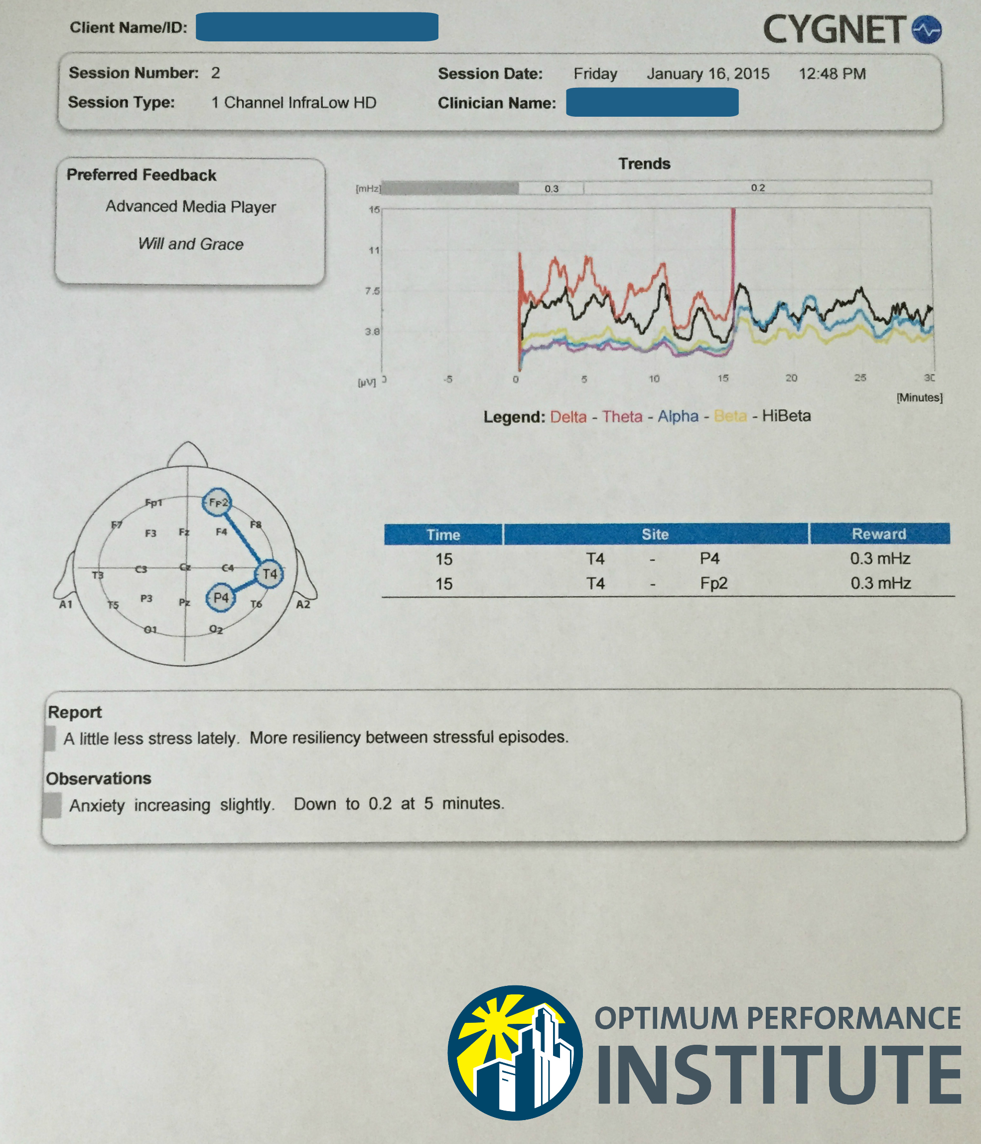 Optimum Performance Institute Offers Neurofeedback to Help “Train the